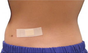 Incisions so small it can be covered with a BANDAID